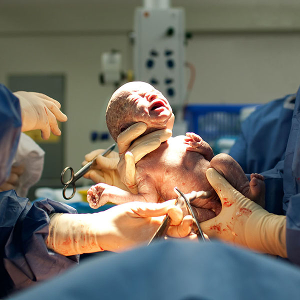 birth injury negligent childbirth infant brain damage medical negligence claims Personal Injury Solicitors Southampton